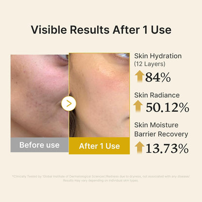 Medicube Jelly Serum Mist