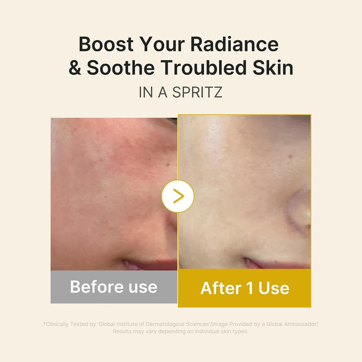 Medicube Jelly Serum Mist